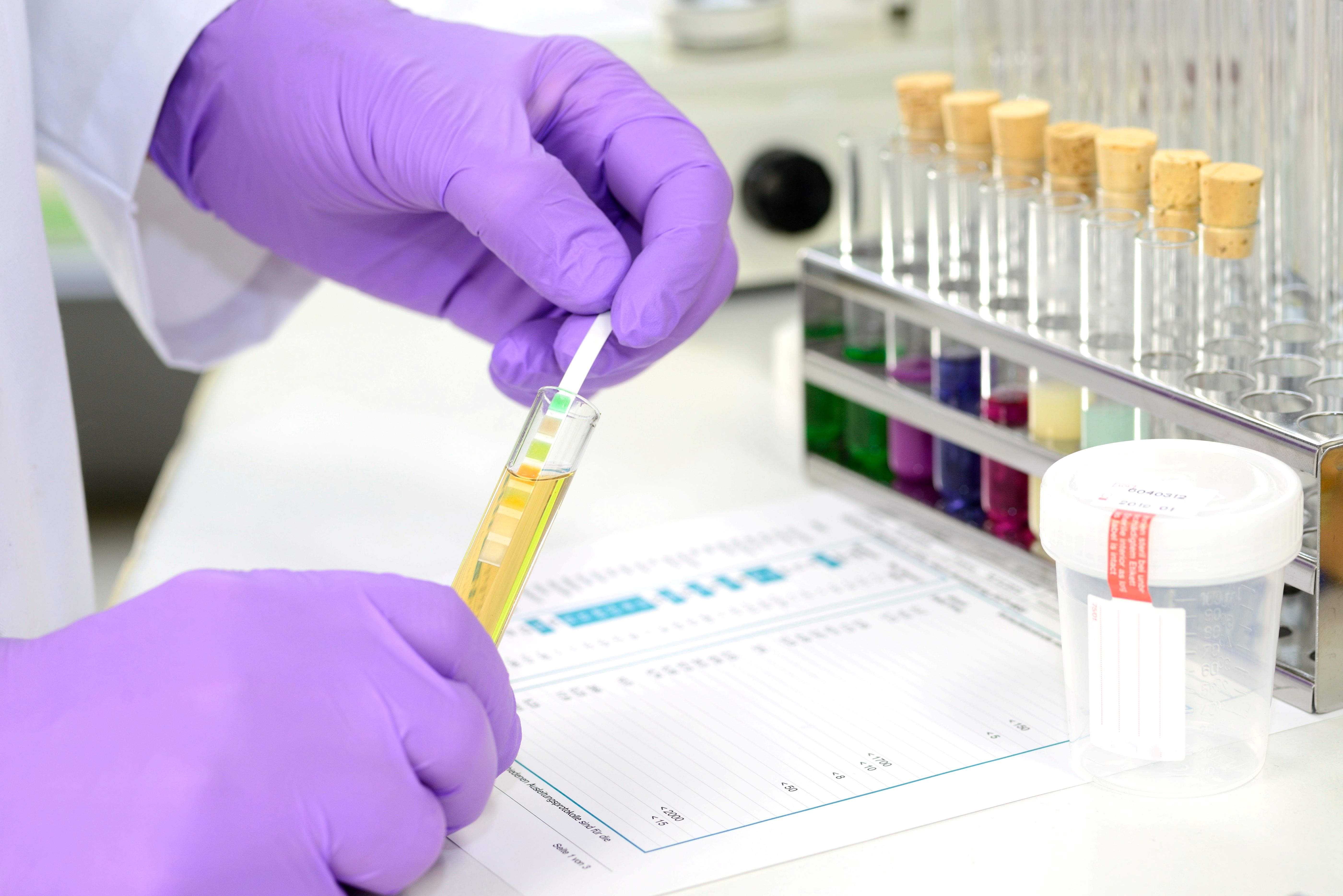 Diabetologische Krisen sicher beherrschen: Ketoazidose und Therapieunterbrechung