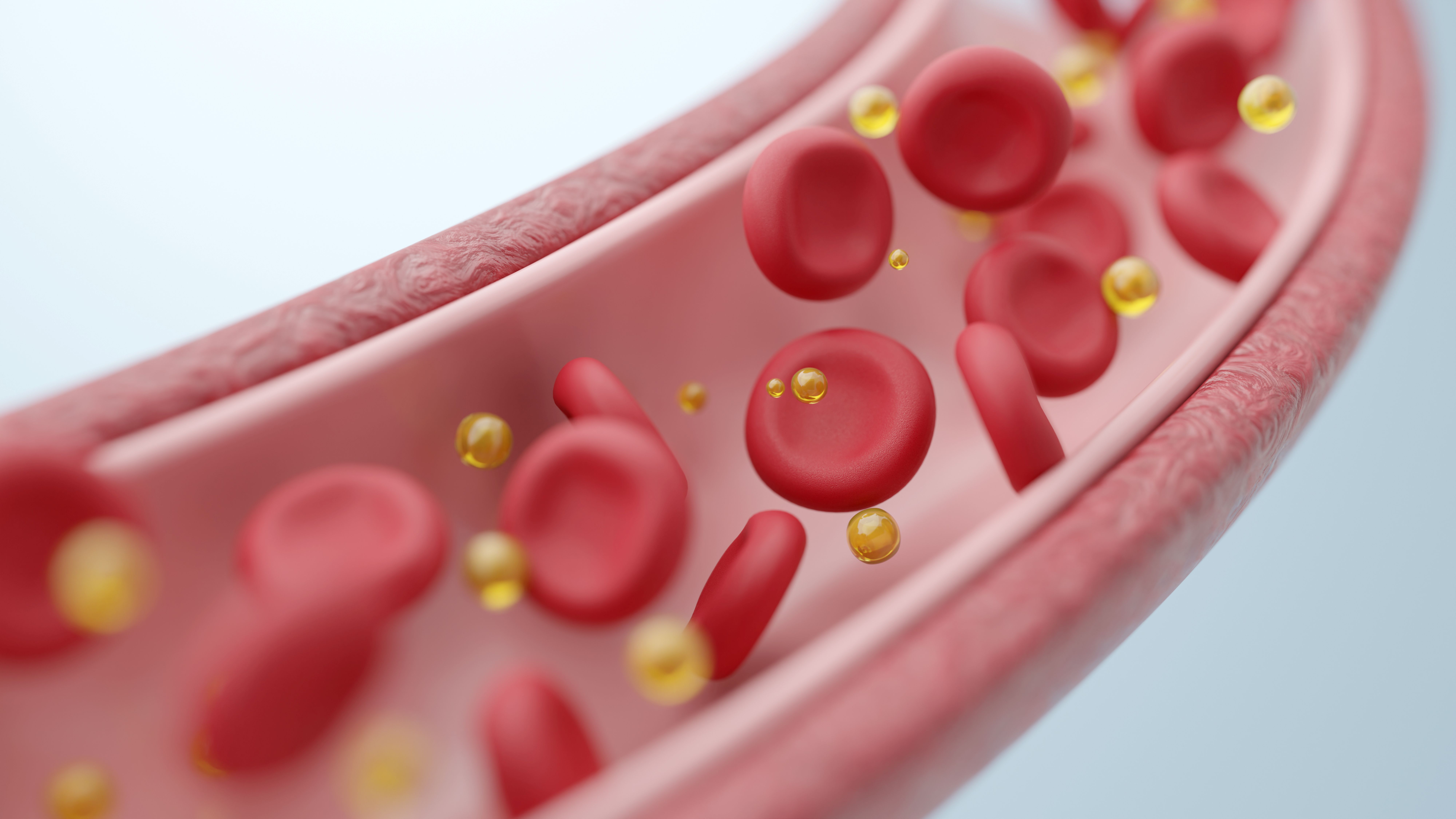 Lipide bei Diabetes 2027: vom Laborwert zur begründeten Eskalation